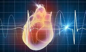 Cardiopatia