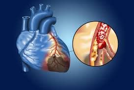 Médica Especialista em Doença Arterial Coronária Imagem