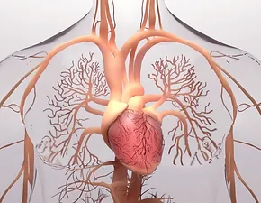 Doença Arterial Coronariana